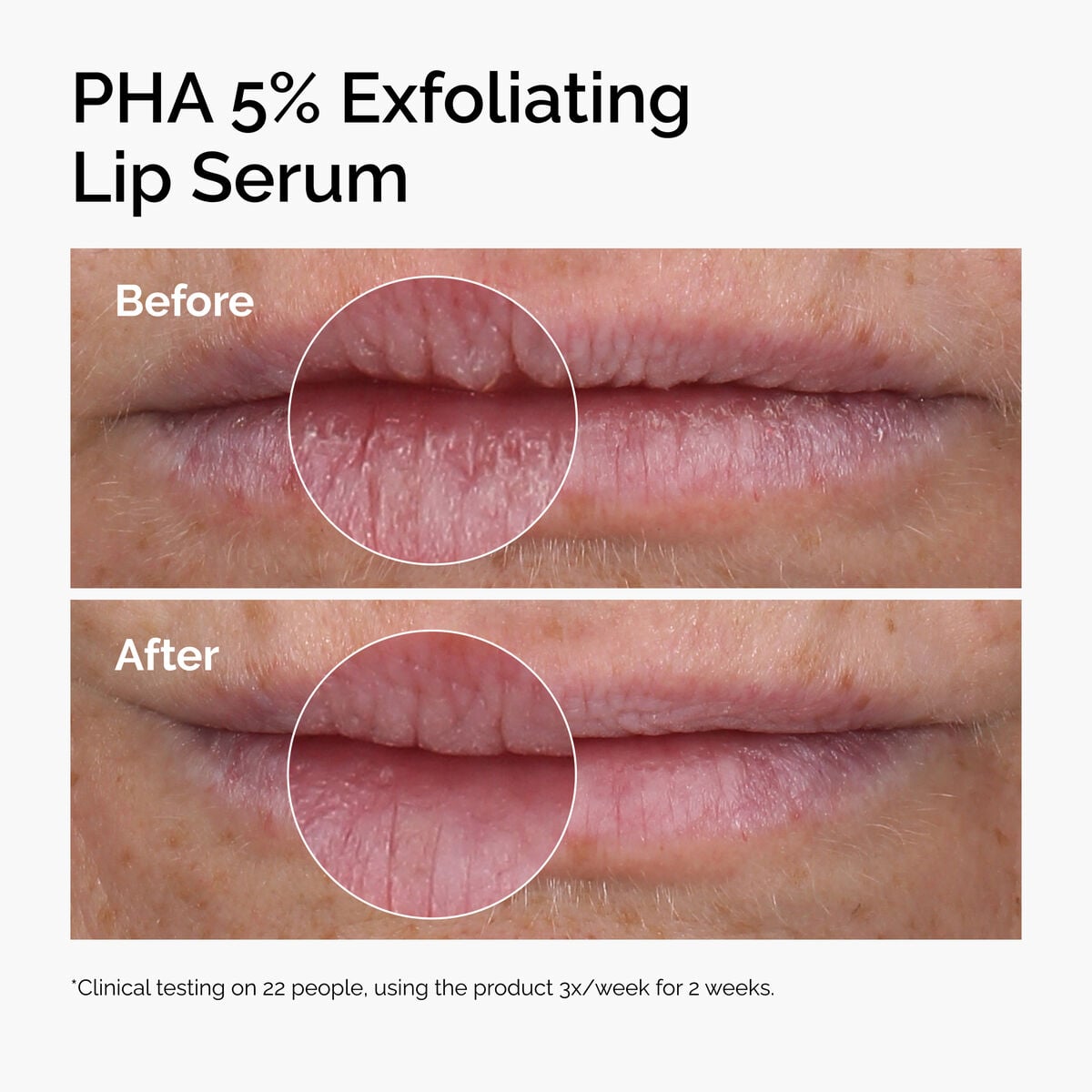 pha-5-exfoliating-lip-serum-o3 ord-pha-5pct-lip-exfoliating-serum-before-after.jpg